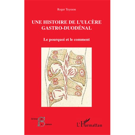 Une histoire de l'ulcère gastro-duodénal