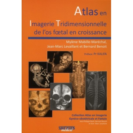 ATLAS EN IMAGERIE TRIDIMENSIONNEELLE DE L OS FOETAL EN CROISSANCE