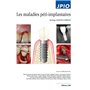 Les maladies péri-implantaires