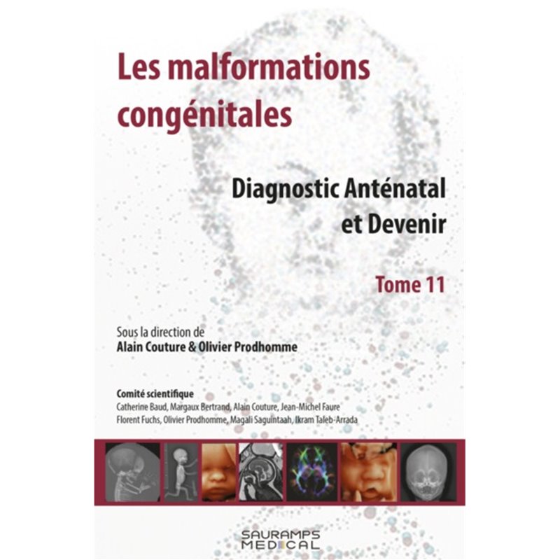 LES MALFORMATIONS CONGENITALES T.11-DIAGNOSTIC ANTENATAL ET DEVENIR ...