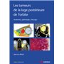 Les tumeurs de la loge postérieure de l'orbite - Tome 2