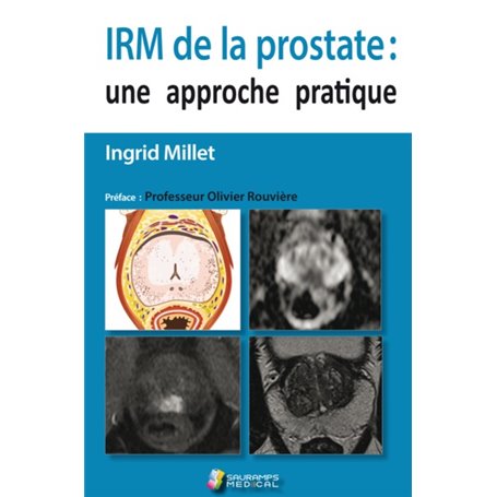 IRM DE LA PROSTATE : UNE APPROCHE PRATIQUE