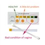 Test Flore vaginale Pour Détection Mycose ou Inflammation lot de 10