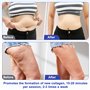 Ibtyzo 40K Masseur Anti Cellulite Appareil Minceur, 4 en 1 Lipocavitation Radiofréquence Visage et Corps Entier Masseur Aminciss