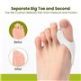 Bunion Cushion Protector - Lot de 8 coussinets correcteurs de bunion pour gros orteils, bouclier en gel pour soulager la douleur