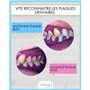 ORAL PREVENT Comprimés de Coloration Dentaire - Pour Enfants/Adultes - À Mâcher Sans Érythrosine - Colorer la Plaque - 40 Pièces