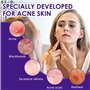 Acné visage rééquilibrant