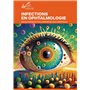 Infections en ophtalmologie