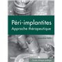 LES PÉRI-IMPLANTITES 88,06 €
