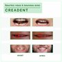 CREADENT -Kit pour remplacer vous même une dent manquante-Dent cosmétique-Fausse dent provisoire pour retrouver le sourire