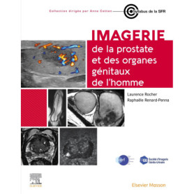 Imagerie de la prostate et des organes génitaux de l'homme Imagerie de la prostate et des organes génitaux de l'homme