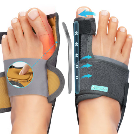 TENICORE Amélioré Hallux Valgus Correcteur avec 2 Barres d'angle，Orthese Hallux Valgus avec Coussin en Silicone Soulagement des 