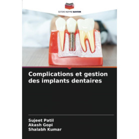 Complications et Gestion des Implants Dentaires : Guide Pratique pour Dentistes