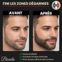 Dermaroller Cheveux et Barbe 0,5mm - Microneedling pour visage - Soin Peau, Barbe et cuir Chevelu - Derma Roller pour Repousse d
