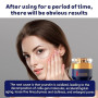 Teegxddy 1 PCS Crème Antirides Raffermissante Aux Polypeptides Qingling, Creme Anti Rides Femme, Crè-me Raffermissante Pour Le V