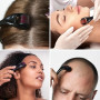 PARENCE.- Derma Roller 0.5mm - Masseur Barbe