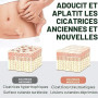Cyberwork Rouleau de Pansement en Silicone pour Cicatrices (4CM x 150CM), Bandage Professionnel pour Soin des Cicatrices, Adapté