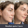 Hero Cosmetics - Rescue Balm Original - Baume Hydratant Réparateur Post-Imperfections - Améliore l’apparence des marques laissée
