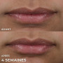 RoC Derm Correxion Lip Volumizer | Volumateur Lèvres, Baume Repulpant à l'Acide Hyaluronique & aux Peptides de Collagène | 10 ml