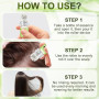 AlphaInfuse Système de croissance des cheveux, solution de repousse des cheveux, solution d'infusion à micro-aiguilles Alpha Inf