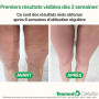 TESMED CELLULITE: Efficacité Clinique, Masseur Manuel Anti Cellulite Breveté, Made in Italy, Appareil de Massage avec Rouleaux A