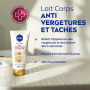 NIVEA Luminous630® Lait Corps Anti Vergetures et Taches (1 x 200 ml), soin corps anti tache hydratant 48h réducteur de vergeture