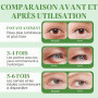 Lot de 60 coussinets contour des yeux à l'aloe vera - Masque hydrogel hydratant contre les cernes, les rides et les gonflements 