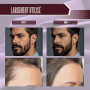2 PièCes Dermaroller Cheveux 0,5 Mm, Rouleau Pour Pousse La Barbe Rouleau Derma Hommes Derma Roller Visage Rollers Micro Aiguill