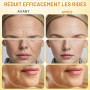 Toivize Crème Anti-Rides au Venin d'Abeille 3 * 20g, Bee Venom Crème | Hydratante et Raffermissante Visage et Cou, Soin Anti-Âge